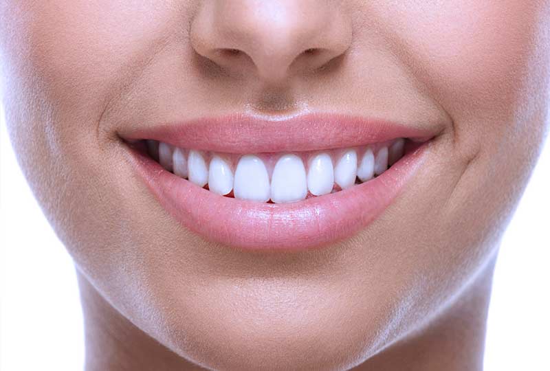 cosmetic dentistry beautiful smile dental veneers