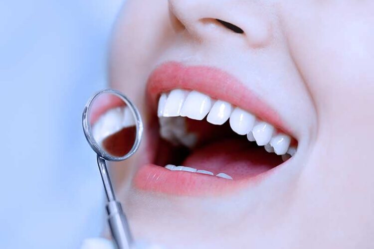 dental exams