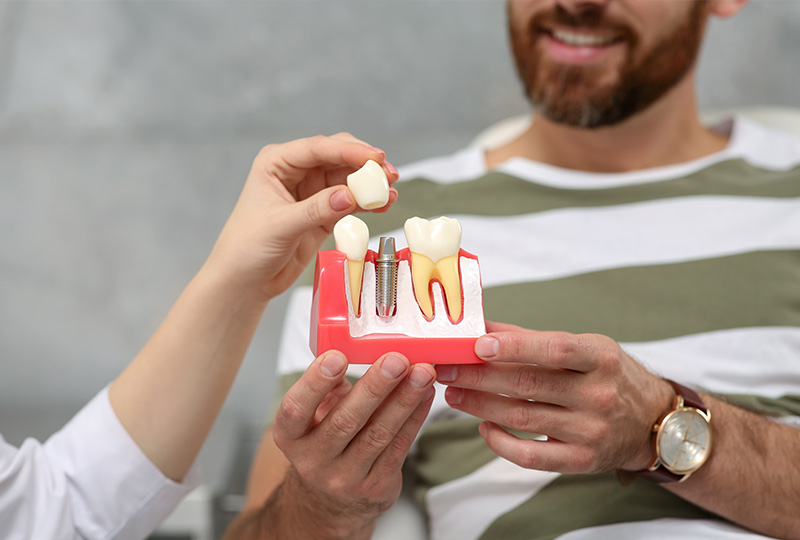 Doctor showing a dental implant model to a patient, representing a dental implant consultation at Deluxe Dental in Miami, Kendall, and Medley.